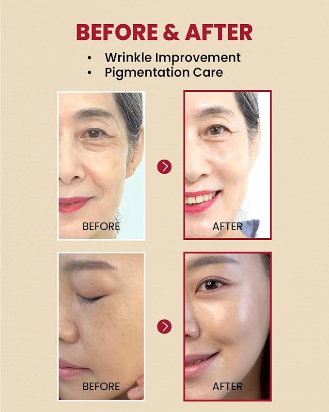 KSECRET SEOUL 1988 Serum : Retinal Liposome 2% + Black Gingeng (58% Black Gingeng Extract with Retinal, Bakuchiol, Vitamin C & 3 Peptides ) for Wrinkle Care - anti-aging, skin elasticity, pigmentation, fine lines and uneven skin tone & texture